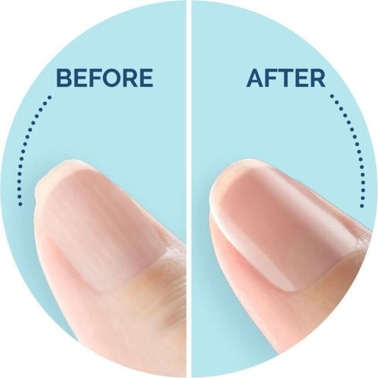 Scholl Velvet Smooth Elektronisches Nagelpflegesystem
